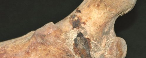 Roman soldier's bone with arrowhead